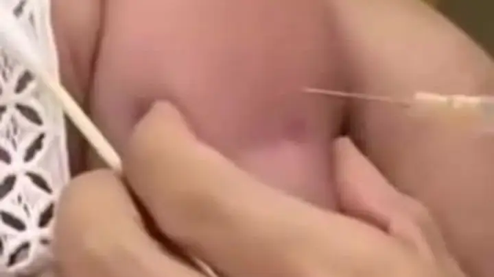 江苏一护士戴手链美甲给宝宝接种疫苗，针头完全扎入胳膊被质疑不专业，卫生院：涉事护士暂时停止调岗