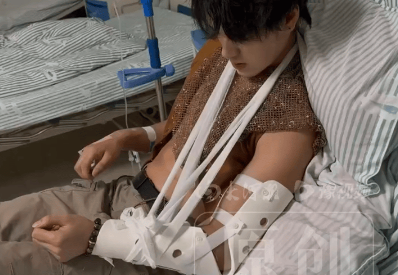 一景区NPC与游客互动被掰断手臂：对方提出掰手腕，突然发力导致其胳膊骨折并晕倒
