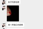 “刺破动脉后,捂住嘴不让她呼救”,男子被控挽回不成杀害前妻