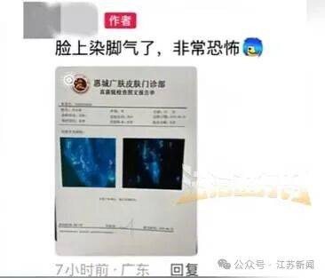 男子健身后脸上染“脚气”，多人曾中招：坐了一会儿，屁股就长了一片痘痘